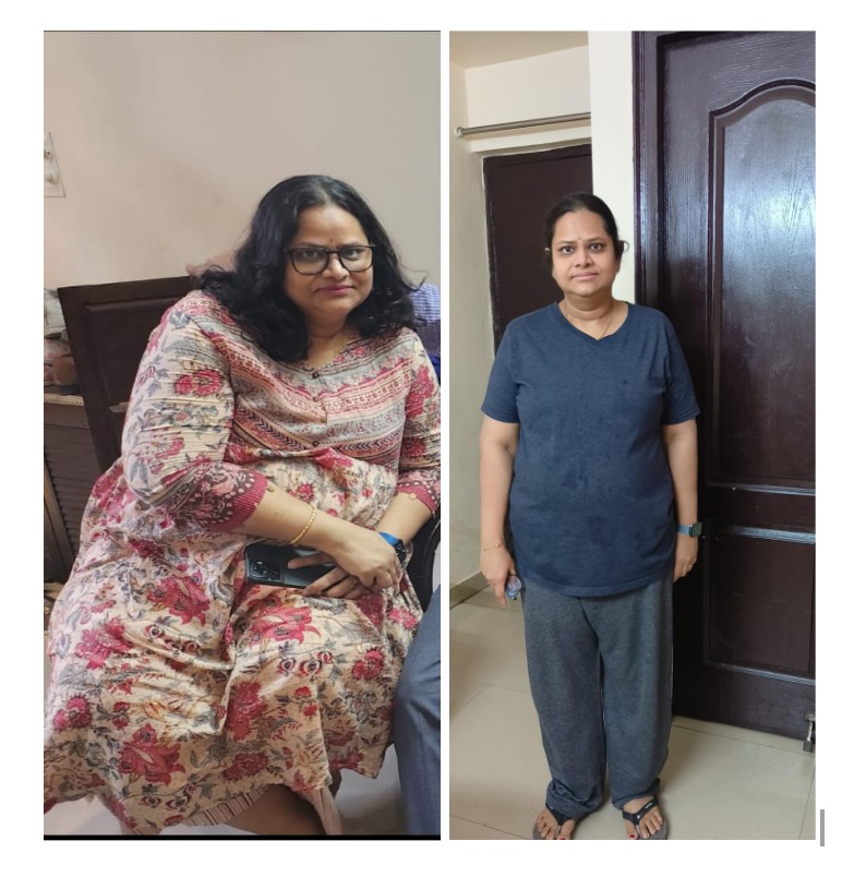 Phalguni Lost 14 Kgs, Reduced HbA1c After 6 Years, and Her Cancer Is Now in Remission!